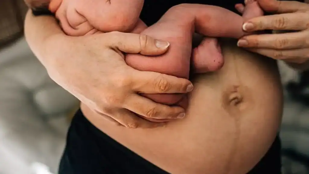 Why Is My Stomach Still Big After Pregnancy Shoreham Beach?